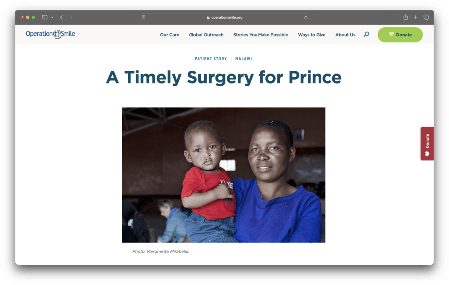 OperationSmile.org A Timely Surgery for Prince page screenshot