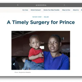 Operation Smile patient story