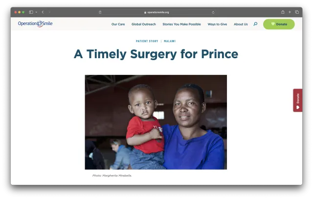 Operation Smile patient story